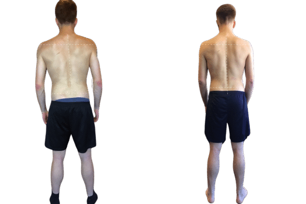 Ellron Health Services | Functional Movement & Posture Alignment Training