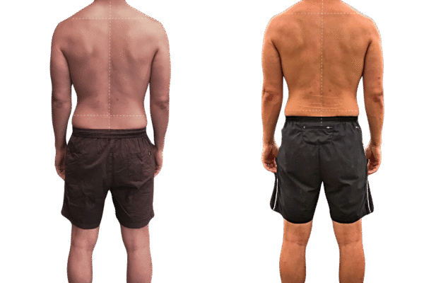 Ellron Health Services | Functional Movement & Posture Alignment Training