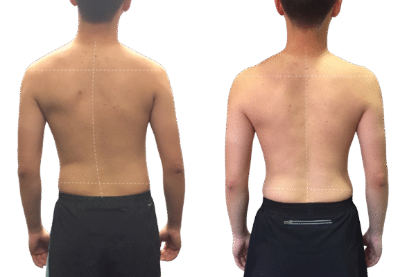 Ellron Health Services | Functional Movement & Posture Alignment Training