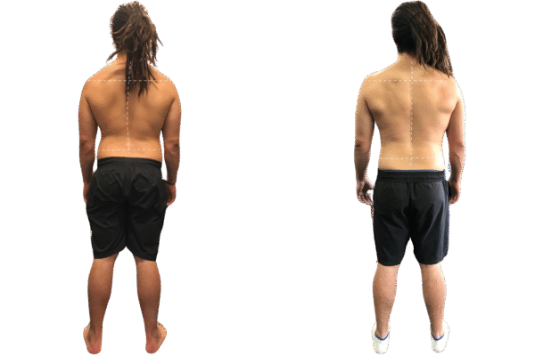 Ellron Health Services | Functional Movement & Posture Alignment Training