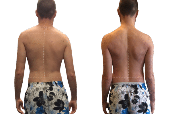 Ellron Health Services | Functional Movement & Posture Alignment Training